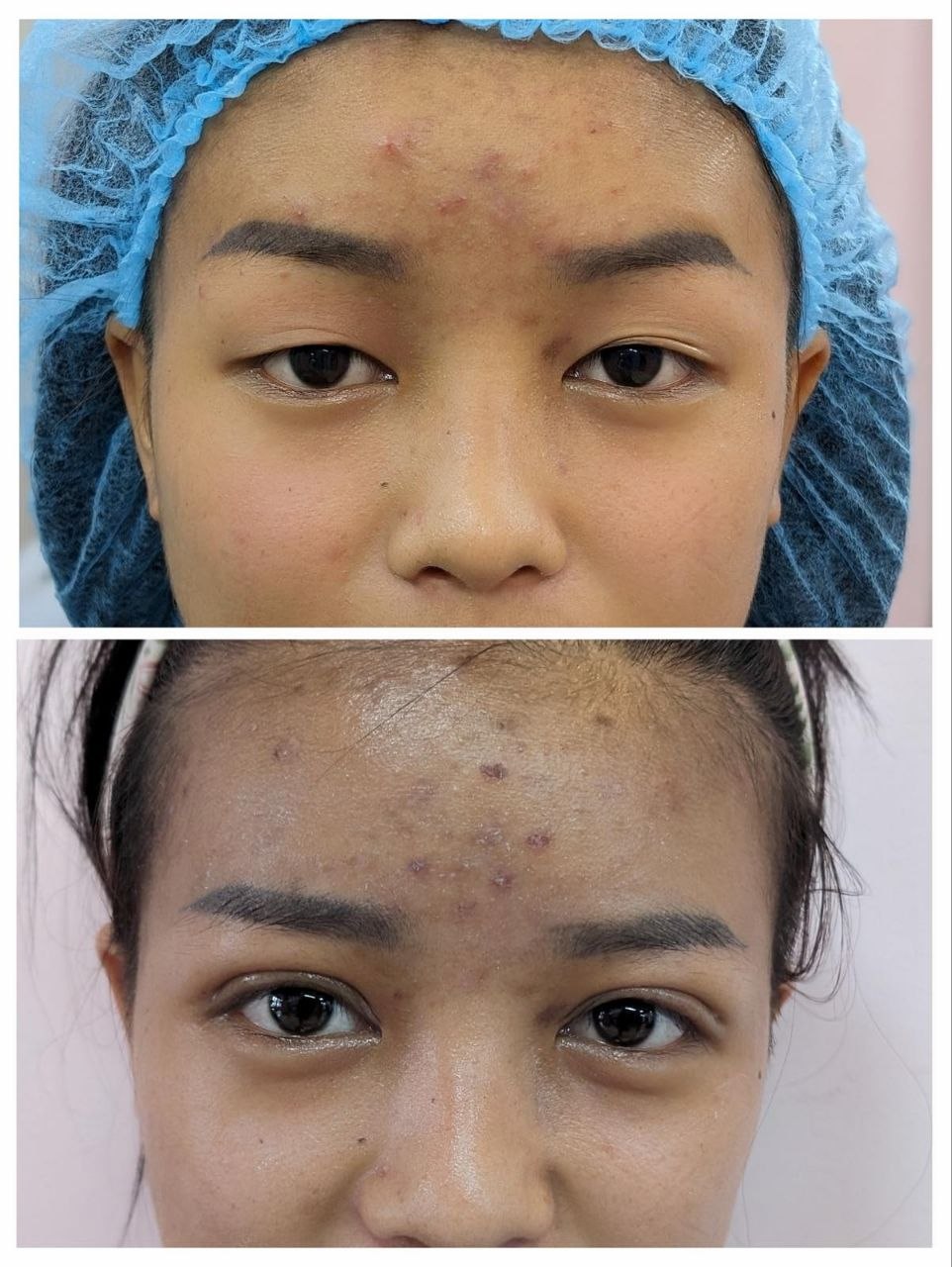 Treatment Result 10
