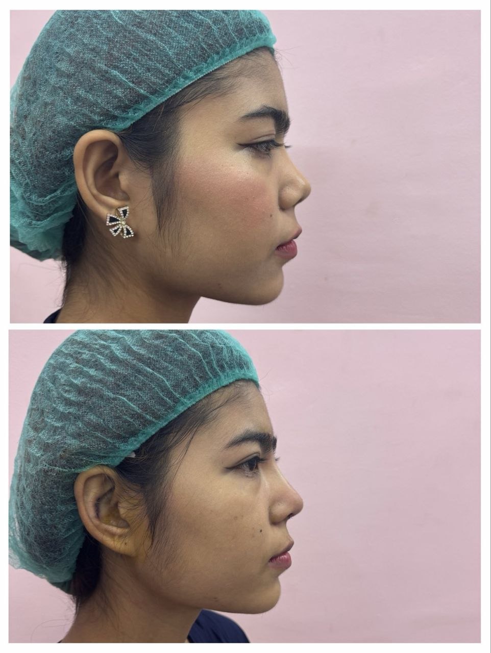 Treatment Result 9